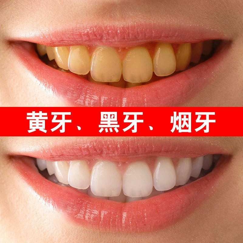 云南本草珍珠亮白牙粉_云南本草珍珠白牙粉怎么用_云南本草珍珠亮白牙粉怎么样