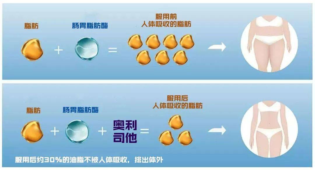apicut脂肪终结者_脂肪终结者效果怎么样_脂肪终结者有人吃过吗
