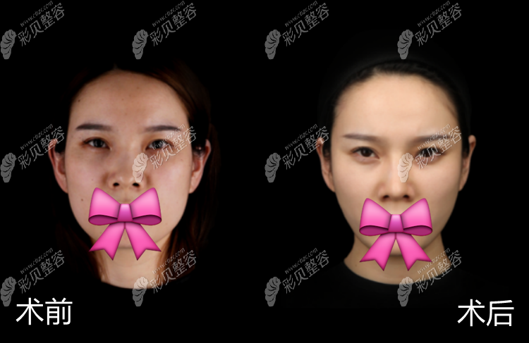 qq彩贝图标怎么熄灭_怎么样点亮qq彩贝图标_qq怎么熄灭图标